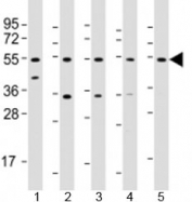 Western blot testing of human 1) liver, 2) HeLa, 3) PC-3, 4) SK-BR-3 and 5) TT cell lysate with THRB antibody at 1:2000. Predicted molecular weight: 52 kDa.