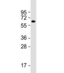 Western blot testing of mouse brain lysate with ZNF238 antibody at 1:2000. Predicted molecular weight: 58 kDa.