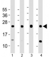 Western blot testing of human 1) A431, 2) HeLa, 3) HepG2 and 4) MCF-7 cell lysate with LITAF antibody at 1:1000. Predicted molecular weight: 17/24 kDa (isoforms 1/2).