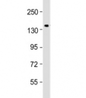 Western blot testing of human kidney lysate with COL4A3 antibody at 1:1000. Predicted molecular weight: 162 kDa.