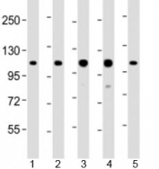 Western blot testing of human 1) HeLa, 2) Jurkat, 3) MOLT-4, 4) CCRF-CEM and 5) DU-145 cell lysate with RAD54B antibody at 1:2000. Predicted molecular weight: 103 kDa.