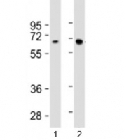 Western blot testing of human 1) Jurkat and 2) MCF-7 cell lysate with HEXB antibody at 1:2000. Predicted molecular weight: 63 kDa.