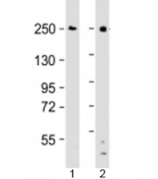 Western blot testing of human 1) Ramos and 2) THP-1 cell lysate with DOCK8 antibody at 1:2000. Predicted molecular weight: 239 kDa.