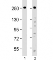 Western blot testing of human 1) HeLa and 2) SH-SY5Y cell lysate with ROBO1 antibody at 1:2000. Expected molecular weight: ~181/250 kDa (unmodified/glycosylated).