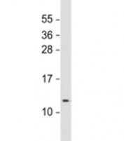 Westen blot testing of human lung lysate with RIG antibody at 1:1000. Predicted molecular weight: 12 kDa.