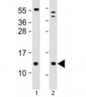 Western blot testing of human 1) human brain and 2) LNCaP cell lysate with C18orf32 antibody at 1:2000. Predicted molecular weight: 9 kDa.