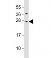 Western blot testing of human HepG2 cell lysate with CIDE B antibody at 1:2000. Predicted molecular weight: 25 kDa.