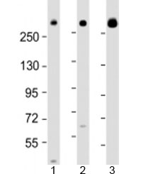 Western blot testing of human 1) 293T/17, 2) HeLa and 3) Jurkat cell lysate with IGF2R antibody at 1:2000. Predicted molecular weight: 274 kDa.