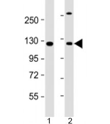 Western blot testing of human 1) A431 and 2) HeLa cell lysate with INTS6 antibody at 1:2000. Predicted molecular weight: 100 kDa.