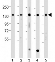 Western blot testing of human 1) A431, 2) HCT116, 3) Jurkat, 4) K562 and 5) U-2OS cell lysate with TACC3 antibody at 1:2000. Expected molecular weight: 90/140-150 kDa (unmodified/phosphorylated).