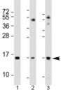 Western blot testing of 1) human A549 cell lysate, 2) mouse lung lysate and 3) mouse small intestine lysate with Phospholipase A2 antibody at 1:2000. Predicted molecular weight: 16 kDa.