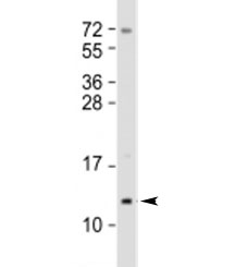 Western blot testing of human T47D cell lysate (mammary gland) with Mammaglobin A antibody at 1:2000. Predicted molecular weight: 10 kDa.