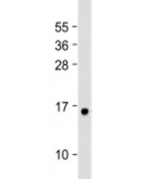 Western blot testing of human plasma lysate with GHRL antibody at 1:2000. Predicted molecular weight: 13 kDa.