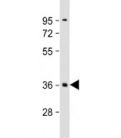Western blot testing of human brain lysate with PLK5 antibody at 1:2000. Predicted molecular weight: 37 kDa.