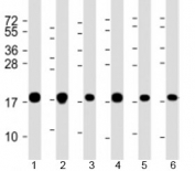 Western blot testing of human 1) A549, 2) HeLa, 3) HepG2, 4) U-2OS, 5) Jurkat and 6) placenta lysate with COMMD1 antibody at 1:2000. Predicted molecular weight: 21 kDa.