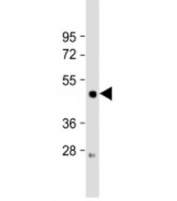 Western blot testing of AGS cell lysate with LIPF antibody at 1:2000. Predicted molecular weight:45kDa
