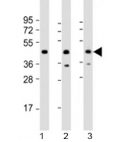 Western blot testing of human 1) 293T/17, 2) Jurkat and 3) K562 cell lysate with PHF6 antibody at 1:2000. Predicted molecular weight: 41 kDa.