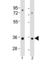 Western blot testing of human 1) A549 and 2) HT-1080 cell lysate with RSPO3 antibody at 1:2000. Predicted molecular weight: 31 kDa.