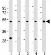 Western blot testing of human 1) HeLa, 2) HT-1080, 3) Jurkat, 4) LNCaP and 5) PC-3 cell lysate with LASS4 antibody at 1:2000. Predicted molecular weight: 46 kDa.