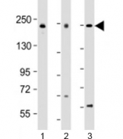 Western blot testing of human 1) A549, 2) Jurkat and 3) K562 cell lysate with PSME4 antibody at 1:2000. Predicted molecular weight: 200-211 kDa.