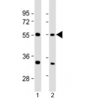 Western blot testing of human 1) 293T/17 and 2) HeLa cell lysate with AAAS antibody at 1:2000. Predicted molecular weight: 60 kDa.