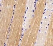IHC testing of FFPE human skeletal muscle with Titin antibody at 1:25. HIER: steamed in pH6 citrate buffer.