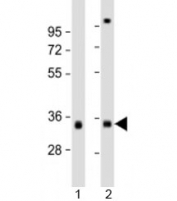 Western blot testing of 1) human skeletal muscle and 2) human heart lysate with TPM3 antibody at 1:2000. Predicted molecular weight: 33 kDa.