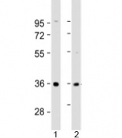 Western blot testing of human 1) liver and 2) SK-BR-3 cell lysate with AKR7A3 antibody at 1:2000. Predicted molecular weight: 37 kDa.