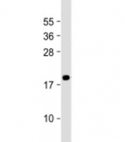 Western blot testing of human PC-3 cell lysate with MEAF6 antibody at 1:2000. Predicted molecular weight: 22 kDa.