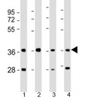 Western blot testing of human 1) 293T/17, 2) liver, 3) HepG2 and 4) SK-BR-3 cell lysate with AKR7A3 antibody at 1:2000. Predicted molecular weight: 37 kDa.
