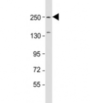 Western blot testing of mouse brain lysate with SPTBN1 antibody at 1:1000. Predicted molecular weight: 275 kDa.
