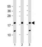 Western blot testing of human 1) A431, 2) SK-BR-3 and 3) U-2OS cell lysate with THRSP antibody at 1:2000. Predicted molecular weight: 17 kDa.