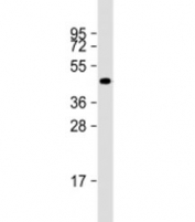 Western blot testing of human A549 cell lysate with NAT16 antibody at 1:2000. Predicted molecular weight: 41 kDa.