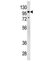 Western blot testing of LLGL2 antibody and 293 cell lysate. Predicted molecular weight ~113 kDa.