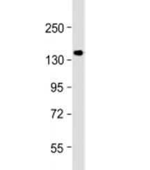 Western blot testing of human MCF-7 cell lysate with GIGYF2 antibody at 1:1000. Predicted molecular weight: 150 kDa.