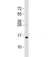 Western blot testing of human HT-1080 cell lysate with TAX1BP3 antibody at 1:2000. Predicted molecular weight: 14 kDa.