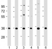 Western blot testing of human 1) A431, 2) HeLa, 3) HepG2, 4) Jurkat, 5) U-2OS and 6) SH-SY5Y cell lysate with NT5C3 antibody at 1:2000. Predicted molecular weight: 38 kDa.