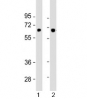 Western blot testing of human 1) SK-BR-3 and 2) TT cell lysate with SLC5A8 antibody at 1:1000. Predicted molecular weight: 67 kDa.