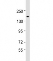 Western blot testing of human HeLa cell lysate with CHD5 antibody at 1:2000. Predicted molecular weight: 223 kDa.