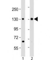 Western blot testing of human 1) HeLa and 2) Jurkat cell lysate with MTUS1 antibody at 1:2000. Predicted molecular weight: 141 kDa.