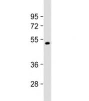 Western blot testing of human NCI-H1299 cell lysate with Factor VII antibody at 1:2000. Predicted molecular weigh ~51 kDa but may be observed at higher molecular weights due to glycosylation.