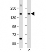 Western blot testing of human 1) brain and 2) lung lysate with MTUS1 antibody at 1:2000. Predicted molecular weight: 141 kDa.
