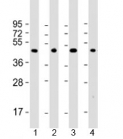 Western blot testing of 1) mouse brain, 2) human A431, 3) rat PC-12 and 4) human U-87 MG cell lysate with Thyroid hormone receptor alpha antibody at 1:2000. Predicted molecular weight: 55 kDa.