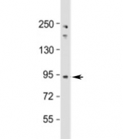 Western blot testing of human Jurkat cell lysate with NUP93 antibody at 1:1000. Predicted molecular weight: 93 kDa.