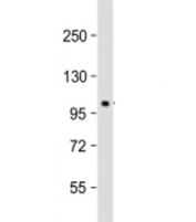 Western blot testing of mouse brain lysate with Pi4ka antibody at 1:2000. Predicted molecular weight: 237 kDa (alpha), 92-110 kDa (beta).