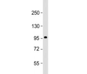 Western blot testing of human skeletal muscle lysate with SULF1 antibody at 1:2000. Predicted molecular weight: 101 kDa.~