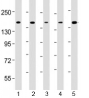 Western blot testing of human 1) K562, 2) Jurkat, 3) HeLa, 4) rat C6 and 5) human MOLT-4 cell lysate with CTCF antibody at 1:4000. Observed molecular weight: 70/82/130 kDa (referred to as CTCF-70, -82 and -130).