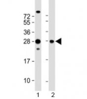 Western blot testing of 1) human HepG2 and 2) rat PC-12 cell lysate with PIMT antibody at 1:2000. Predicted molecular weight: 25 kDa.