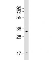 Western blot testing of human ZR-75-1 cell lysate with TAS2R50 antibody at 1:1000. Predicted molecular weight: 35 kDa.