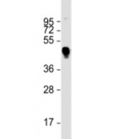 Western blot testing of MBP-tagged MART1 lysate with MBP tag antibody at 1:2000. Predicted molecular weight: 43 kDa.